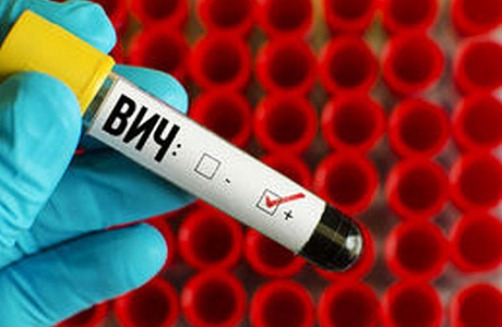 ВИЧ