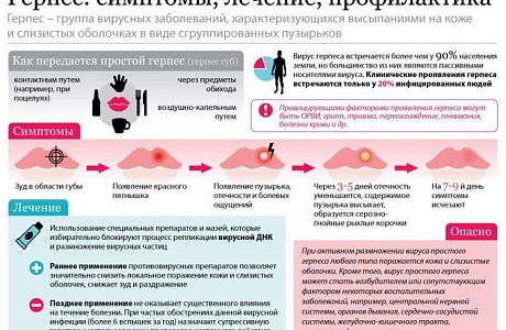 Простой герпес