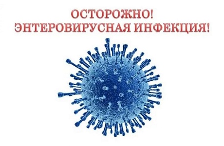 Энтеровирусная инфекция